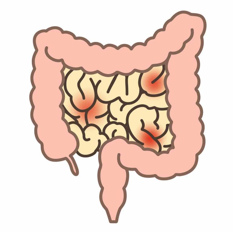 小腸がんイメージ